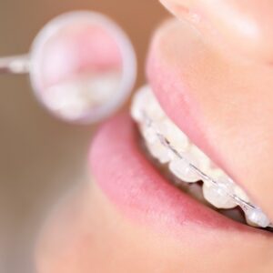 ORTHODONTIE, VOIES AÉRIENNES & ATM
